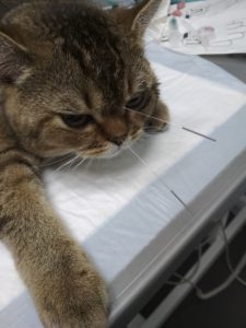 акупунктура