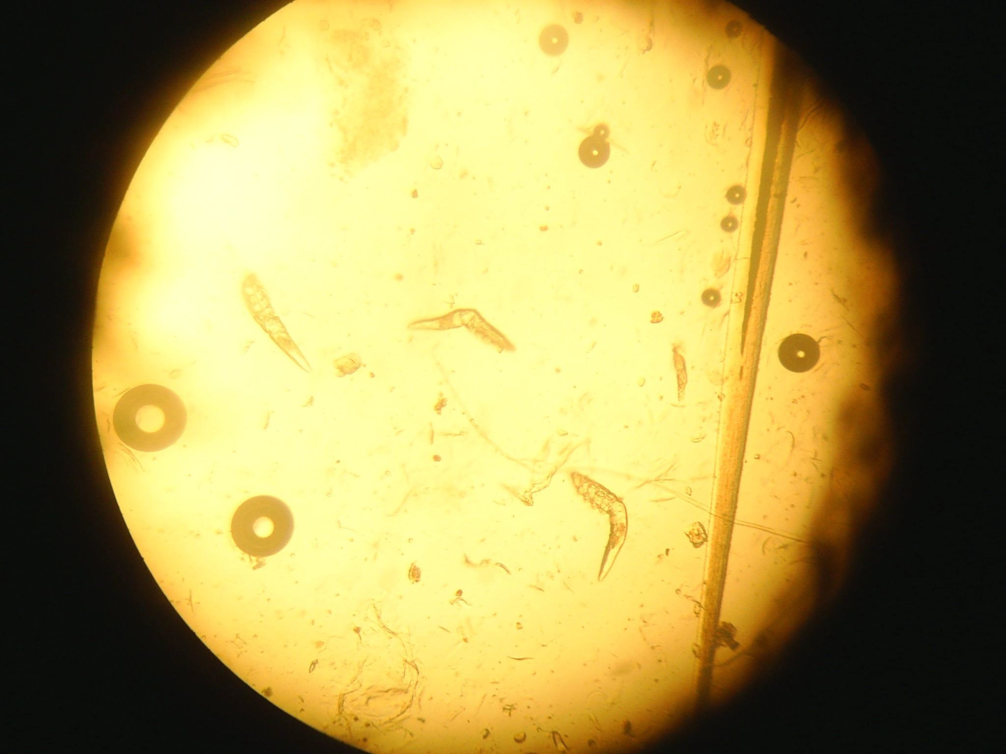 Клещ Demodex под микроскопом